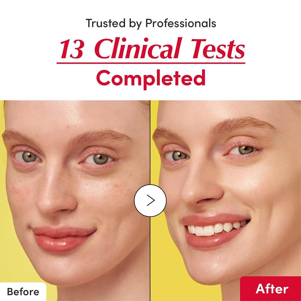 سرم ضدلک و روشن کننده مدل Vitamine Illuminating اکوآل بری 30 میلی لیتر — تصویر ۵