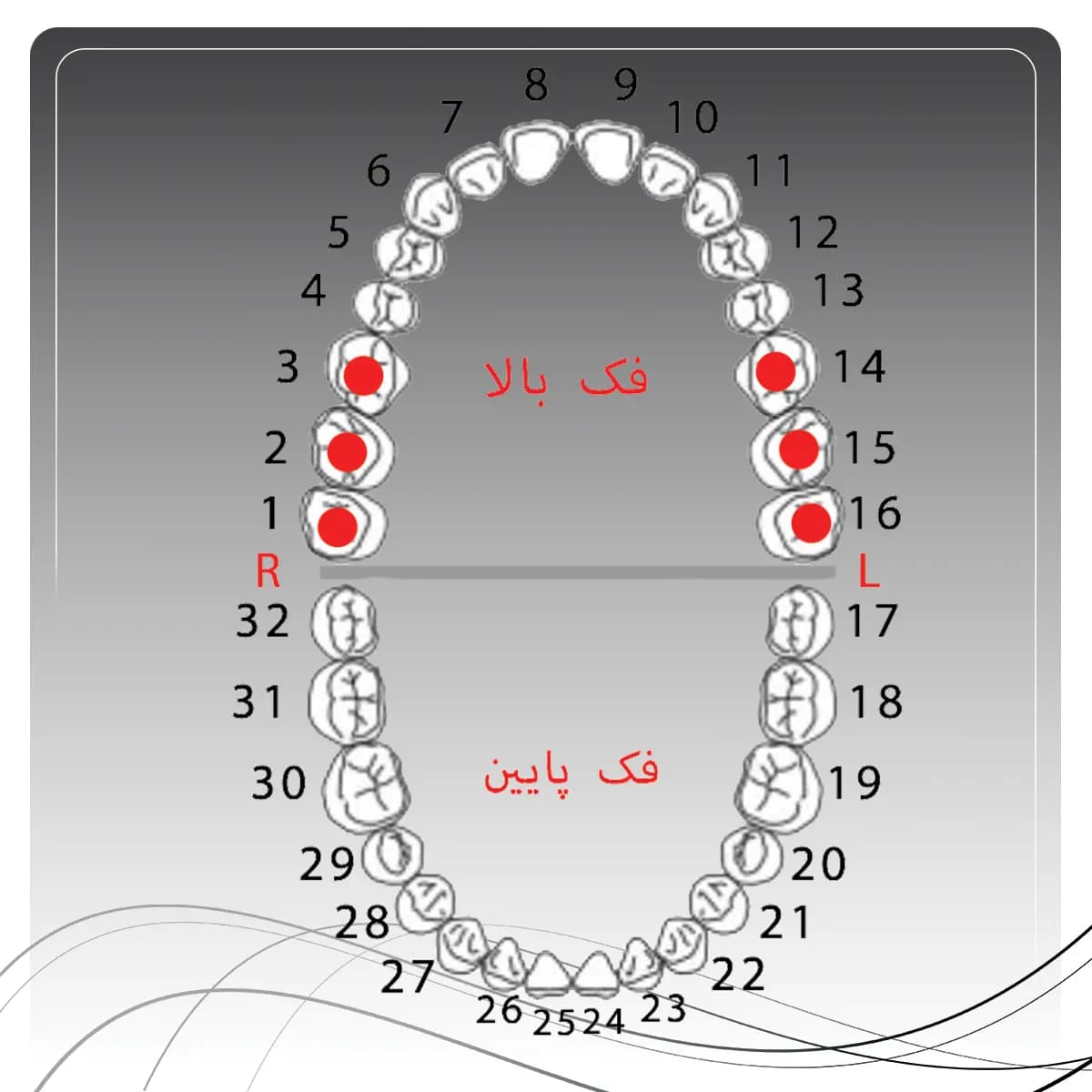 کلمپ رابردم مولر بالا چپ و راست راکمد C26N — تصویر ۳