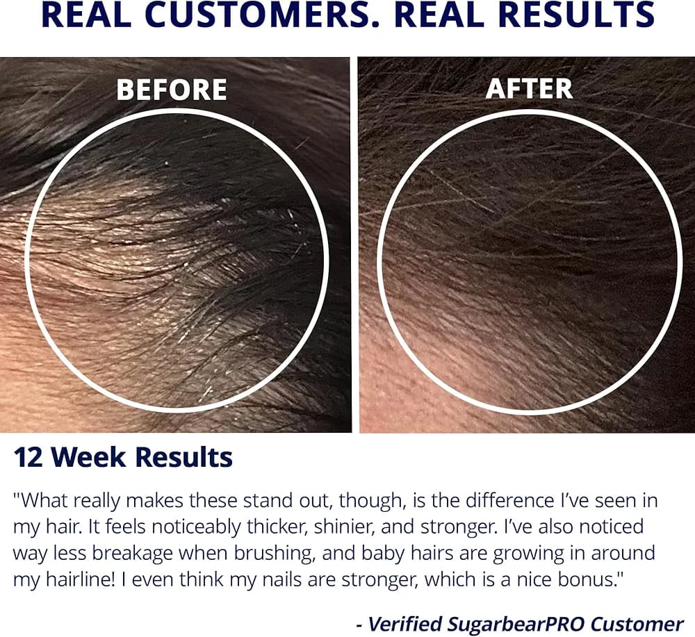 پاستیل تقویت مو شوگر بیرهیر پرو | Sugar Bear Hair Pro — تصویر ۶