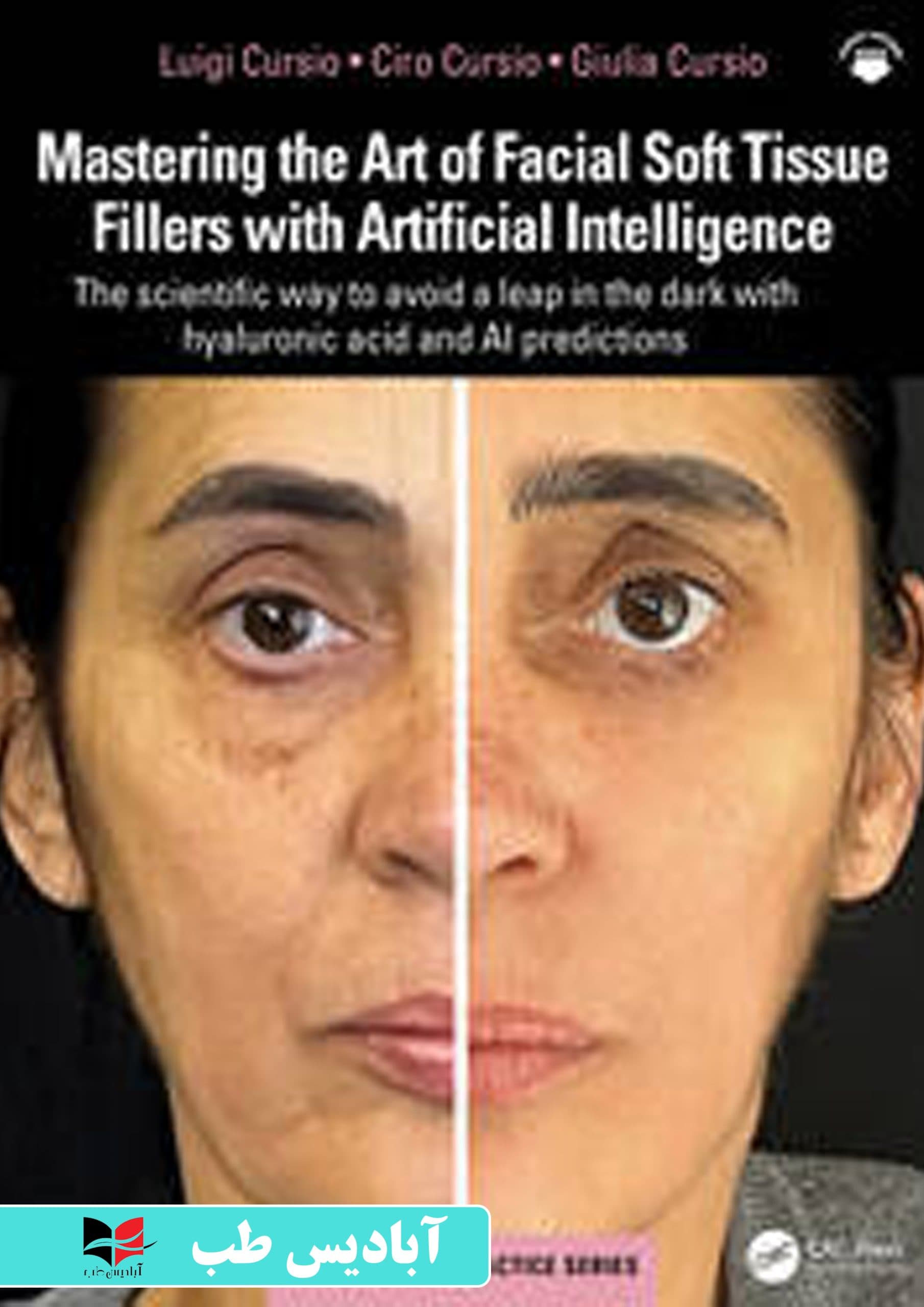 Mastering the Art of Facial Soft Tissue Fillers with Artificial Intelligence The scientific way to avoid a leap in the dark with hyaluronic acid and AI predictions | تسلط بر هنر پرکننده‌های بافت نرم ص