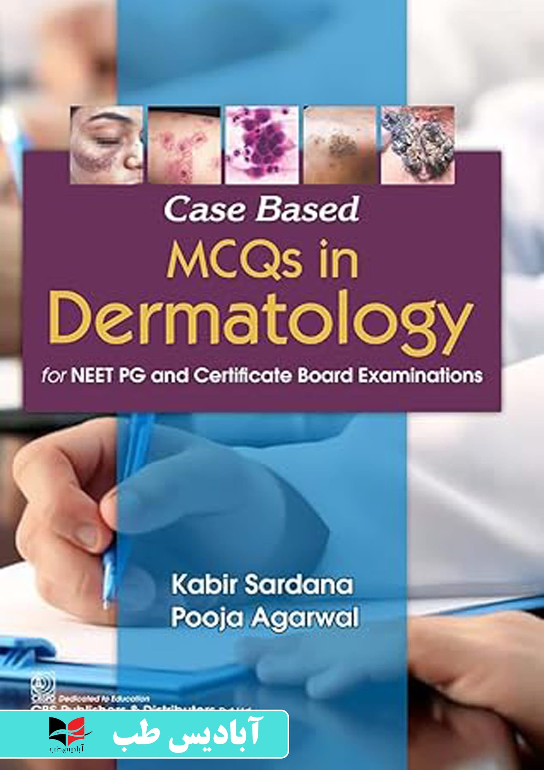 Case Based MCQs in Dermatology for NEET PG and Certificate Board Examinations | سوالات چندگزینه‌ای مبتنی بر مورد در رشته پوست برای آزمون‌های NEET PG و هیئت صدور گواهینامه