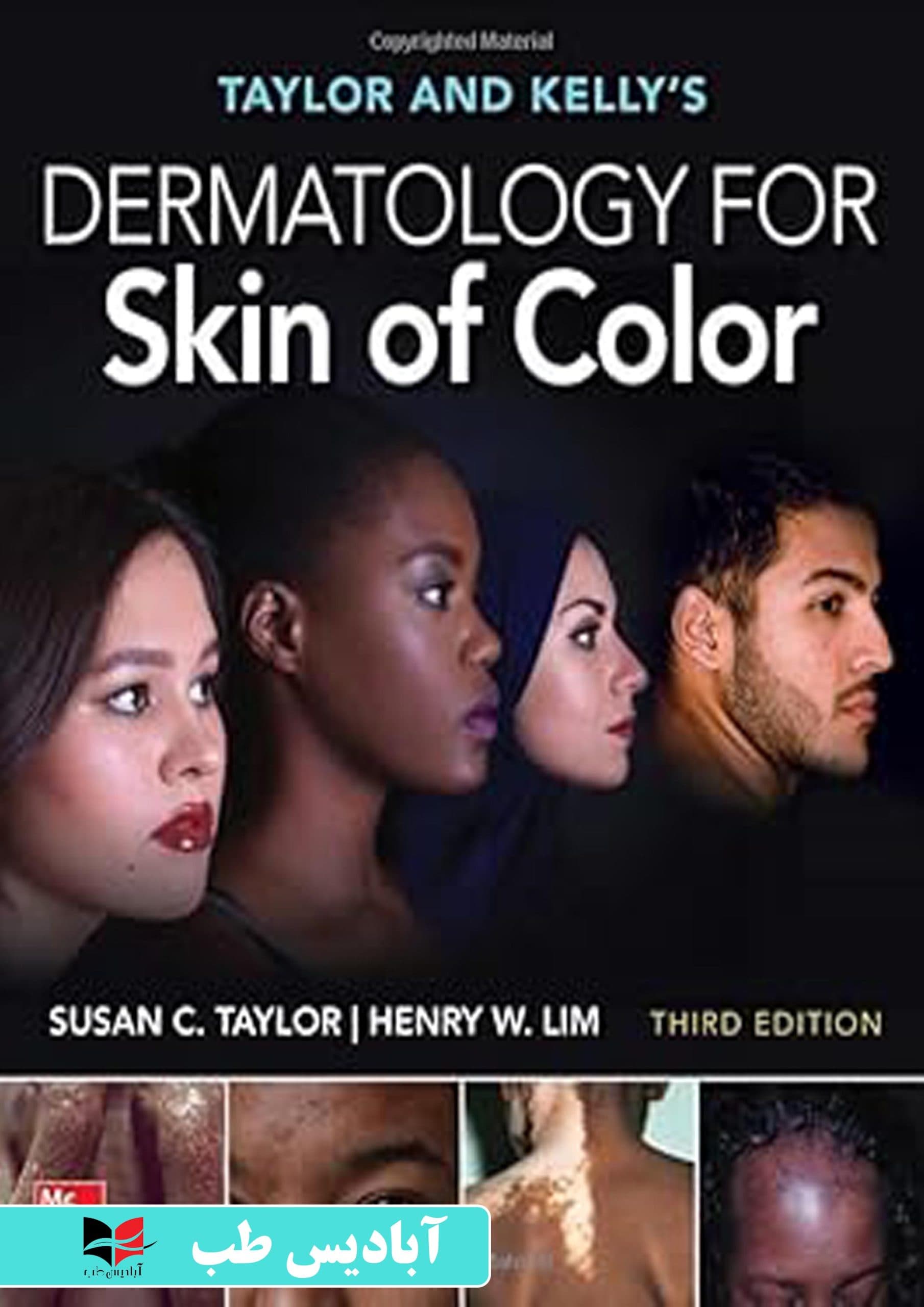 Taylor and Kelly’s Dermatology for Skin of Color, Third Edition 3rd Edition | کتاب پوستشناسی تیلور و کلی برای پوستهای رنگی، ویرایش سوم، ویرایش سوم