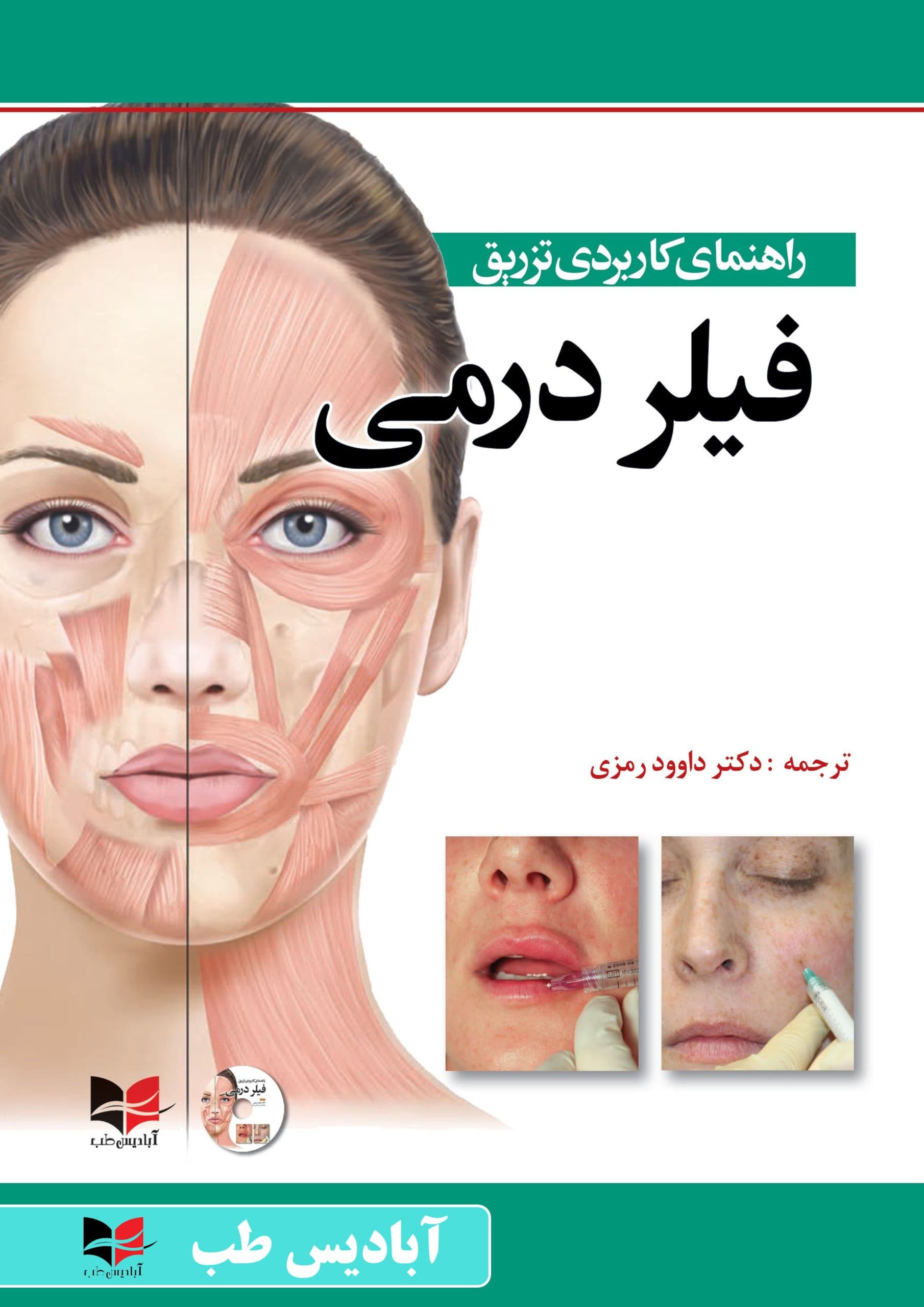 پکیج تزریق فیلر در زیبایی — تصویر ۵