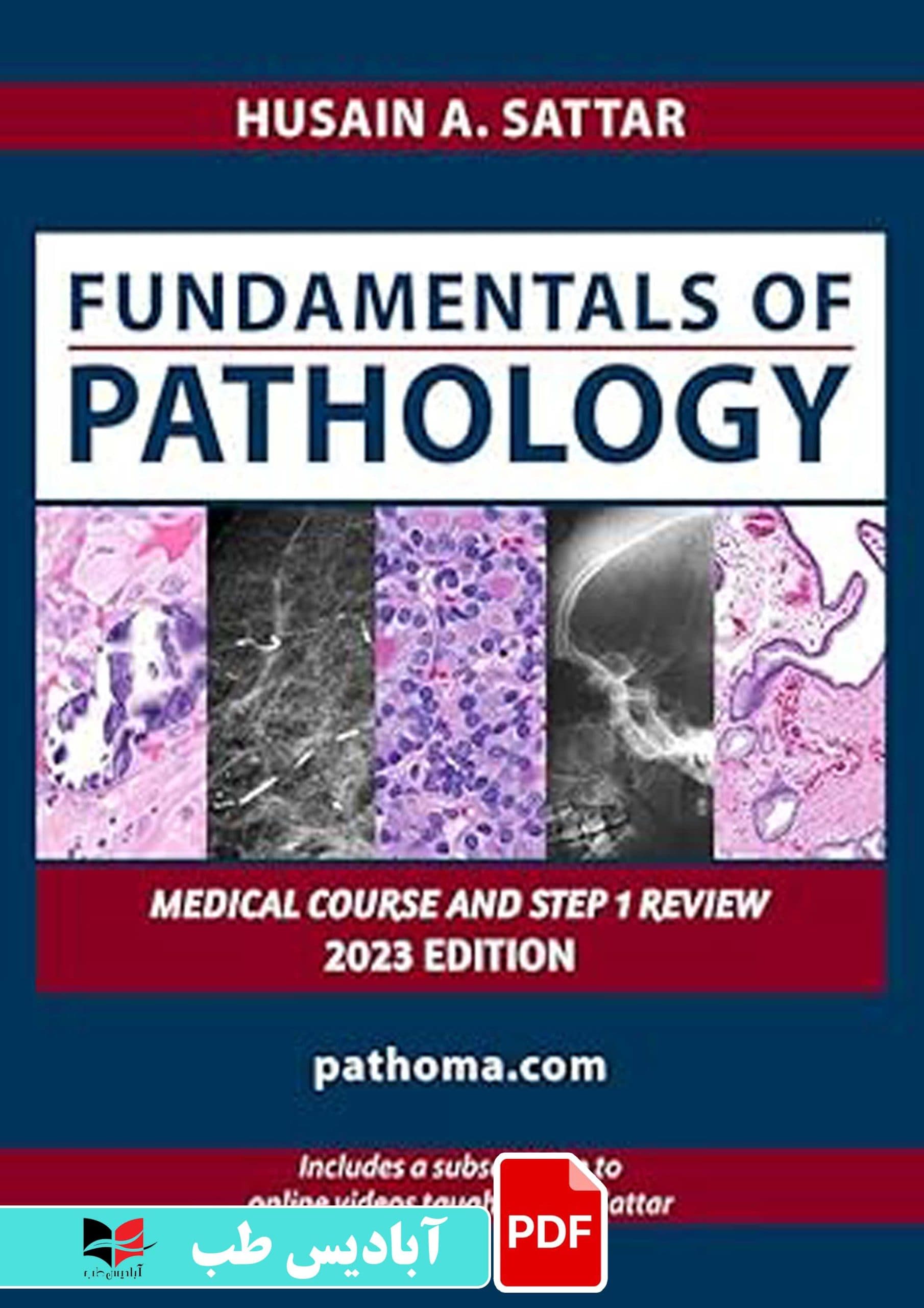فایل پی دی اف (PDF) – PATHOMA 2023 FUNDAMENTALS OF PATHOLOGY FOR STEP 1