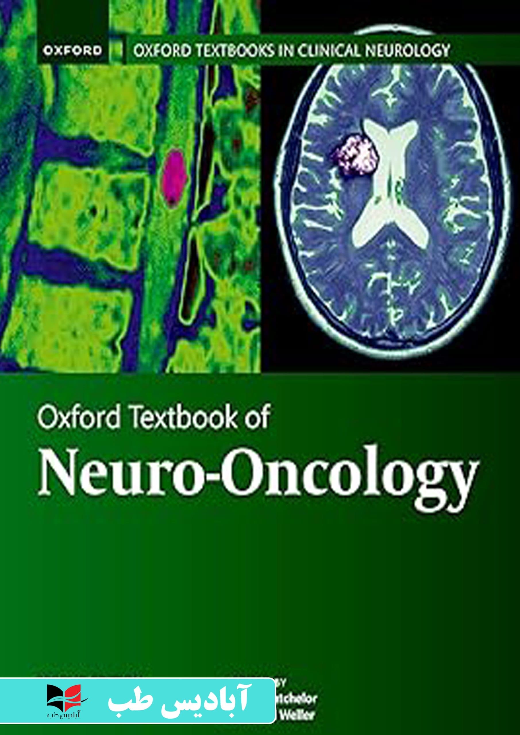 Oxford Textbook of Neuro-Oncology (Oxford Textbooks in Clinical Neurology) 2nd Edition | کتاب درسی نوروانکولوژی آکسفورد (کتاب‌های درسی آکسفورد در نورولوژی بالینی) ویرایش دوم