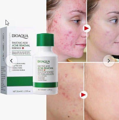 سرم صورت ضد جوش و آکنه سالیسیلیک اسید حجم 35 میل