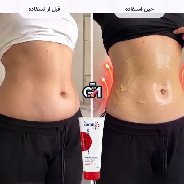 ژل چربی سوز سان من — تصویر ۵
