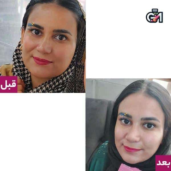 پک سفید کننده دو عددی لزل — تصویر ۷