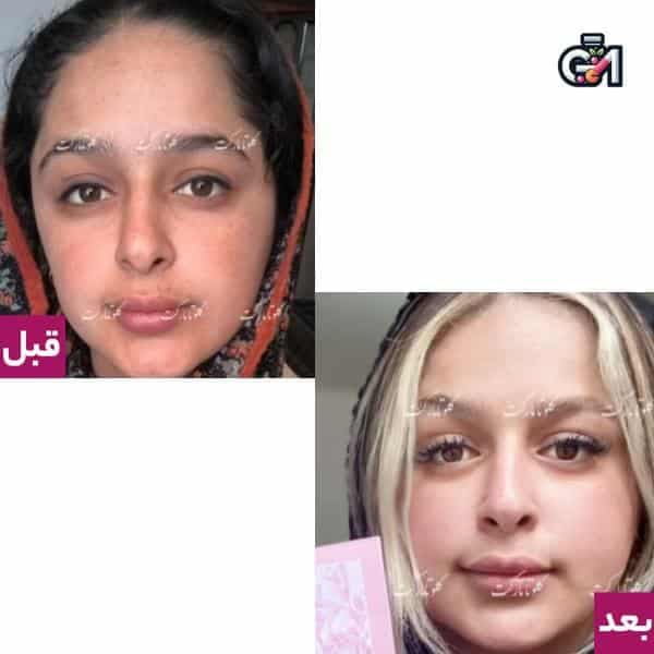 پک تخفیفی شفاف کننده و کلاژن ساز(لزل+آبمیوه) — تصویر ۳