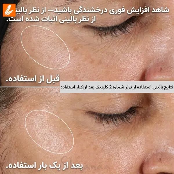 تونر کلینیک شماره 2 پوست مختلط تا خشک — تصویر ۸