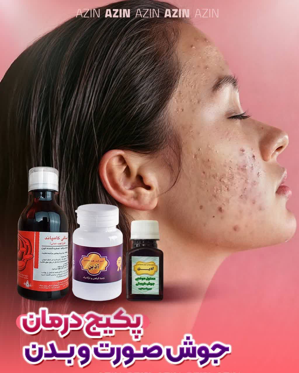 پکیج درمان جوش صورت و بدن