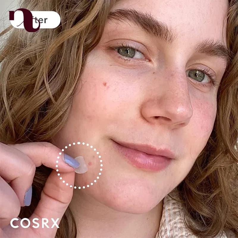 پچ ضدجوش کوزارکس COSRX Acne Pimple Master Patch — تصویر ۷