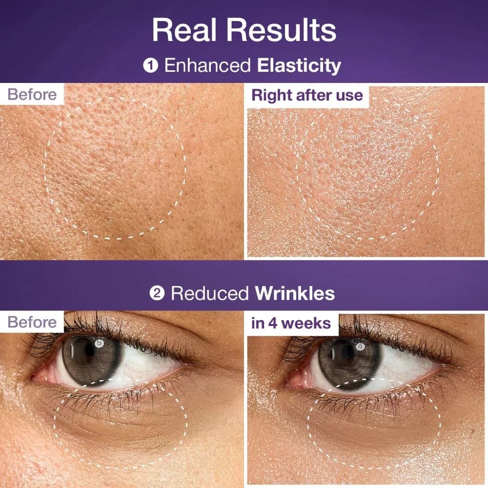 کرم دور چشم نامبوزین شماره ۹ رتینول + NAD+ | Numbuzin No.9 Eye Cream — تصویر ۴