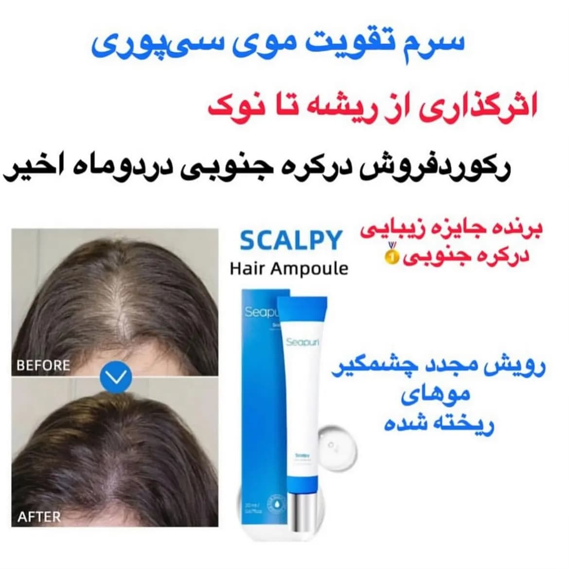 سرم اسکالپی سیپوری تقویت کننده و ضد ریزش مو — تصویر ۴