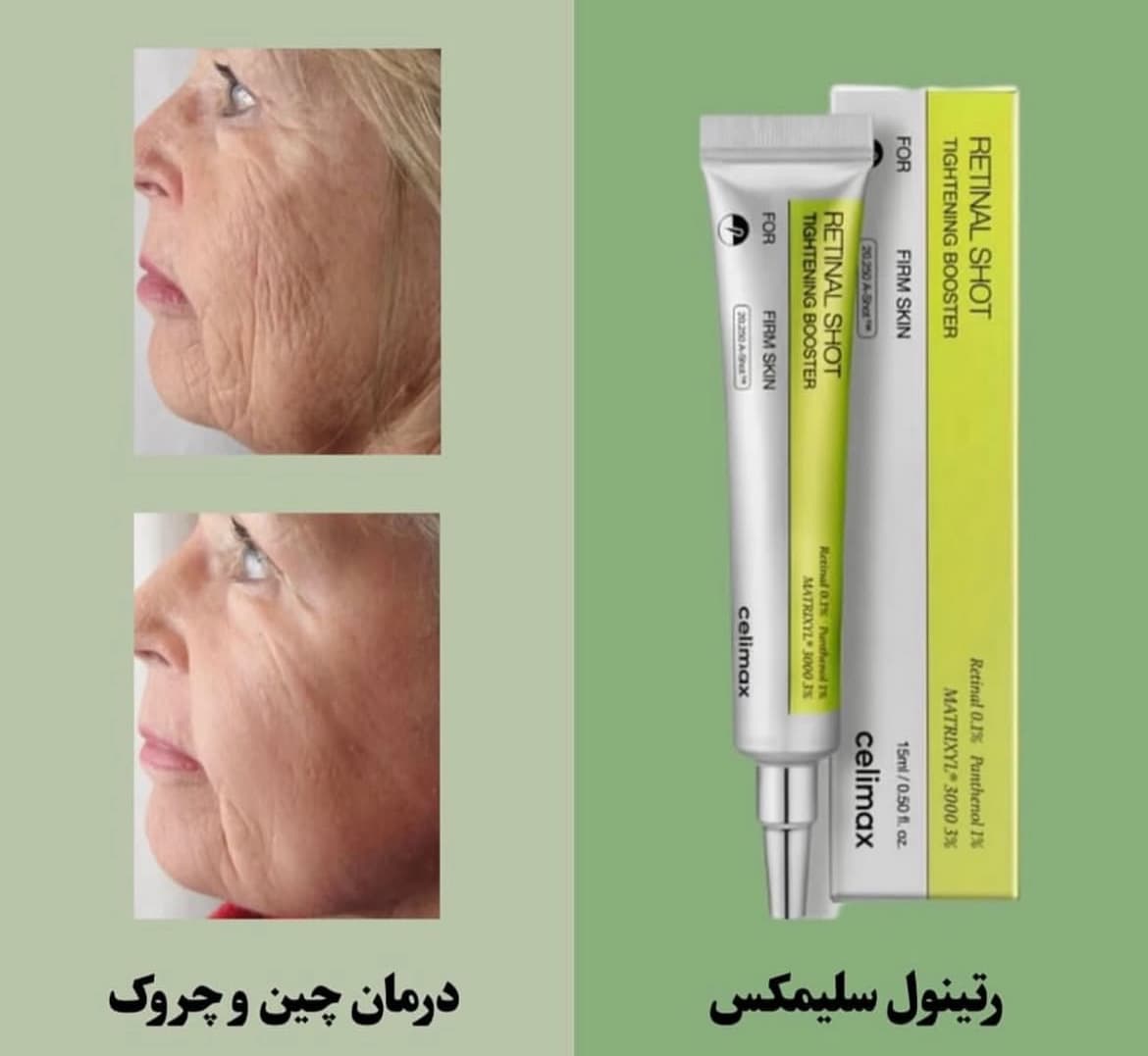 کرم رتینال شات سلیمکس|Celimax RETINAL SHOT TIGHTINING BOOSTER — تصویر ۸