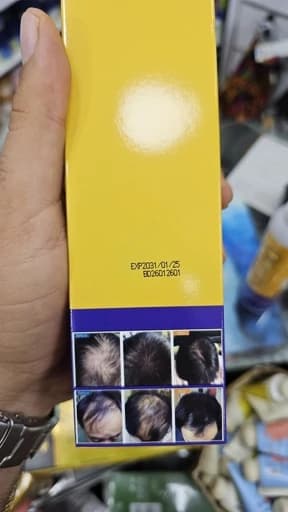 کربوکسی کف سر اوجی پلکس اورجینال حجم 300 میل ضد ریزش و درمان چربی و شوره کف سر — تصویر ۲