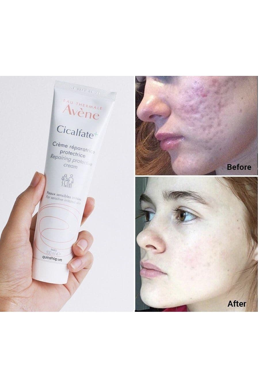 کرم ترمیم کننده سیکالفیت پلاس Avene اون — تصویر ۲