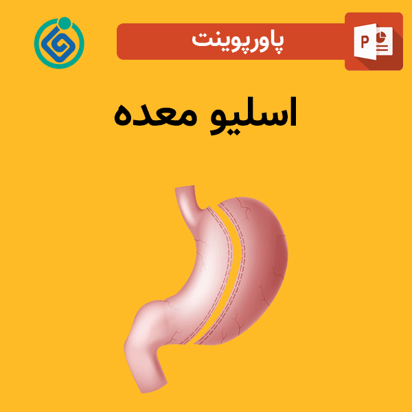 پاورپوینت اسلیو معده