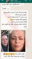 کرم ضدلک گیاهی اورجینال — تصویر ۴