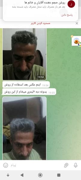 روغن گیاهی رفع سفیدی مو، ریش و ابرو – حجم 30 میلیلیتر — تصویر ۵