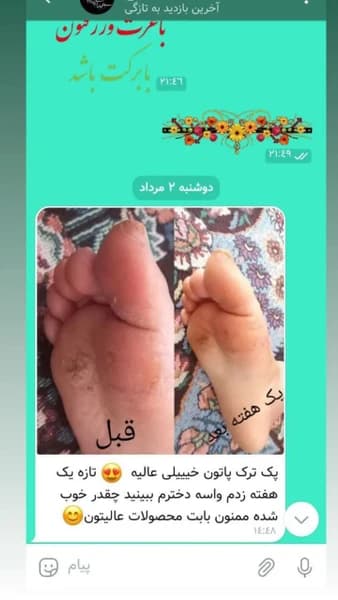 کرم ترک پا دست ساز حجم 30 گرم — تصویر ۳