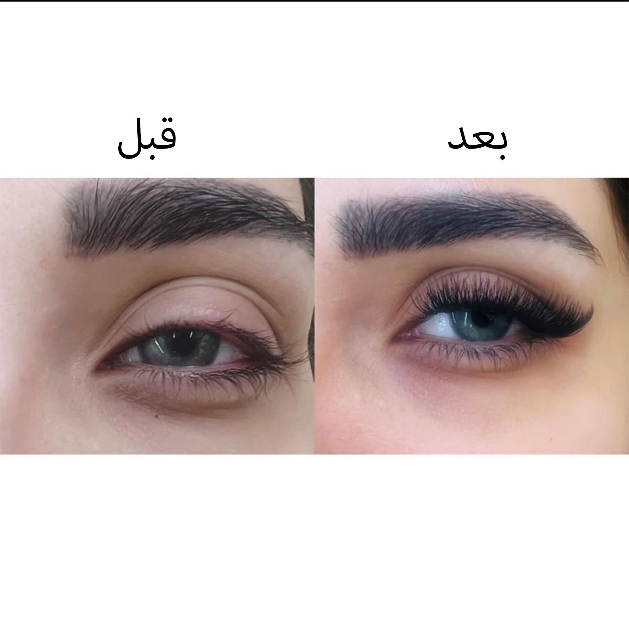 مژه دو‌مگنتی نچرال — تصویر ۳