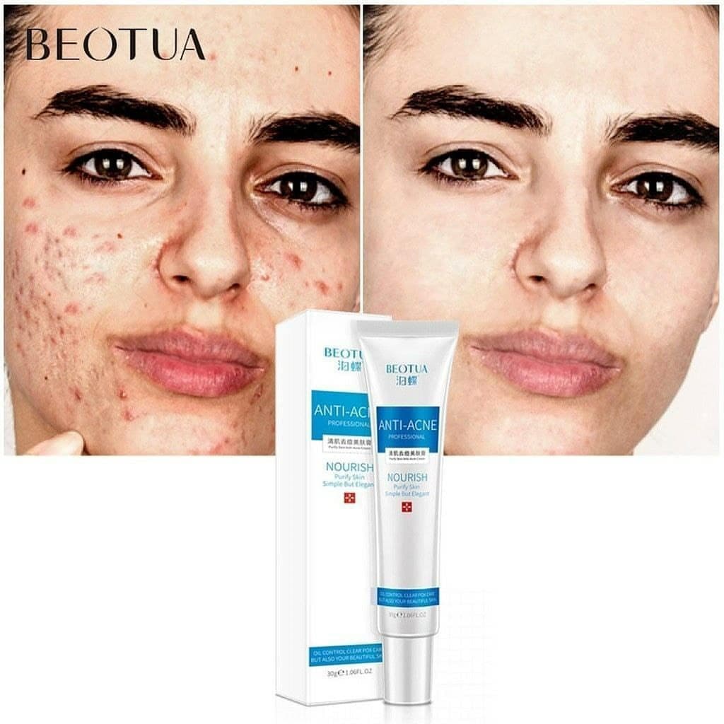 کرم ضدجوش beotua