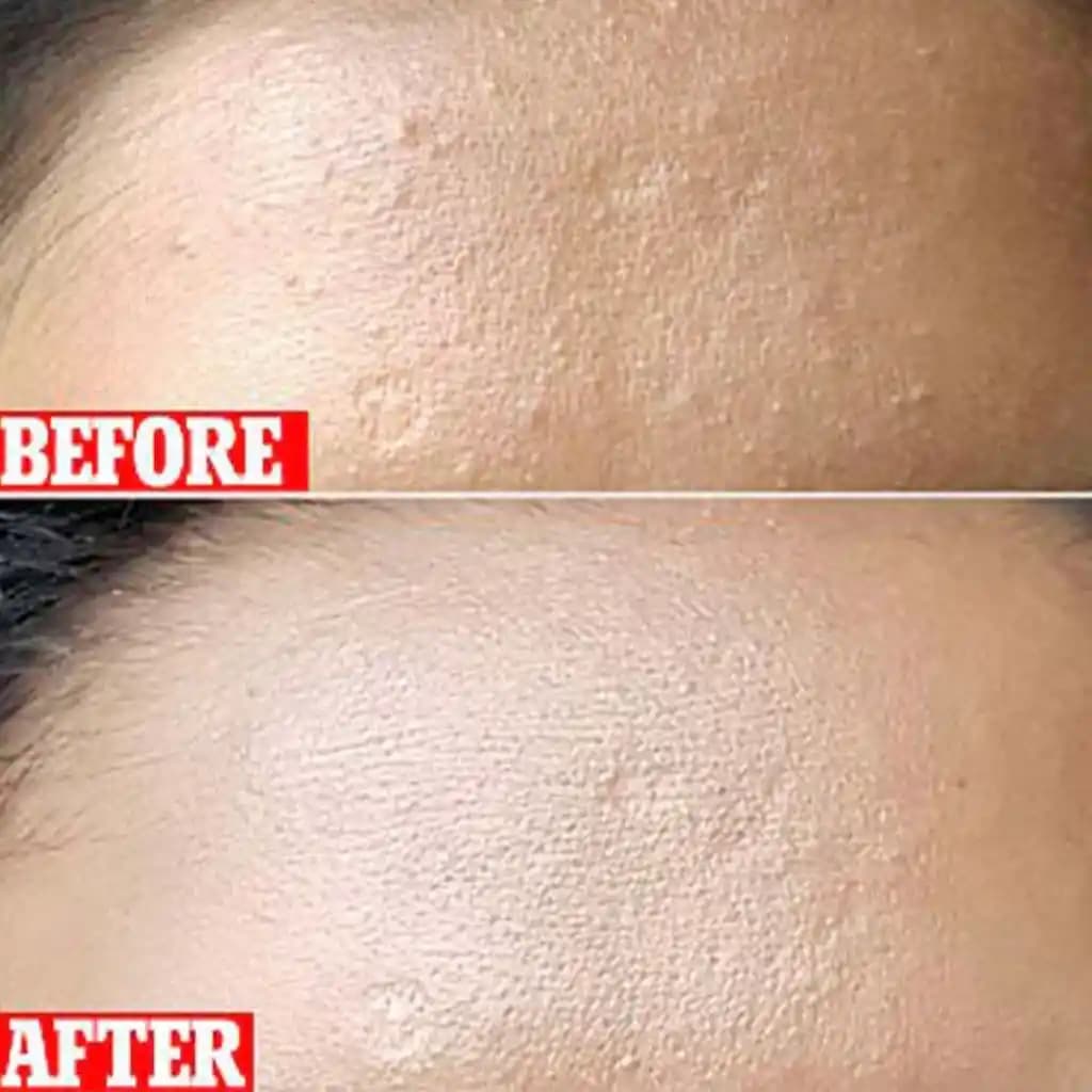 سرم لایه بردار کوزارکس AHA 7% Whitehead Power Liquid — تصویر ۲