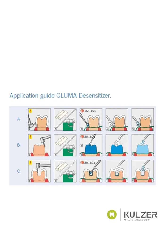 مایع ضد حساسیت کولزر Gluma Desensitizer kulzer — تصویر ۵