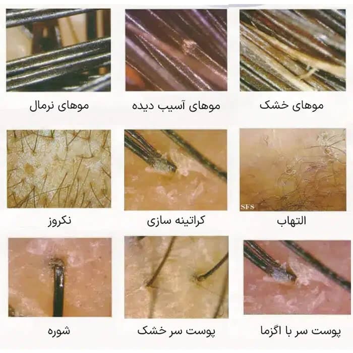 دستگاه اسکالپ مو و سر 5 کاره — تصویر ۳