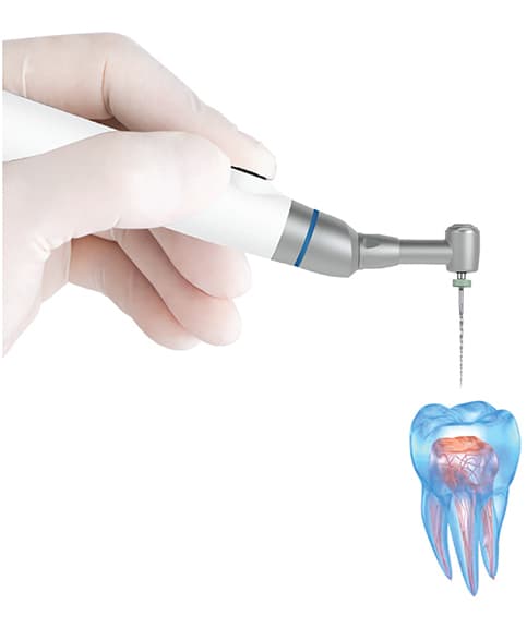 روتاری بی سیم میکرو ان ایکس Micro Nx مدل Endoit — تصویر ۵