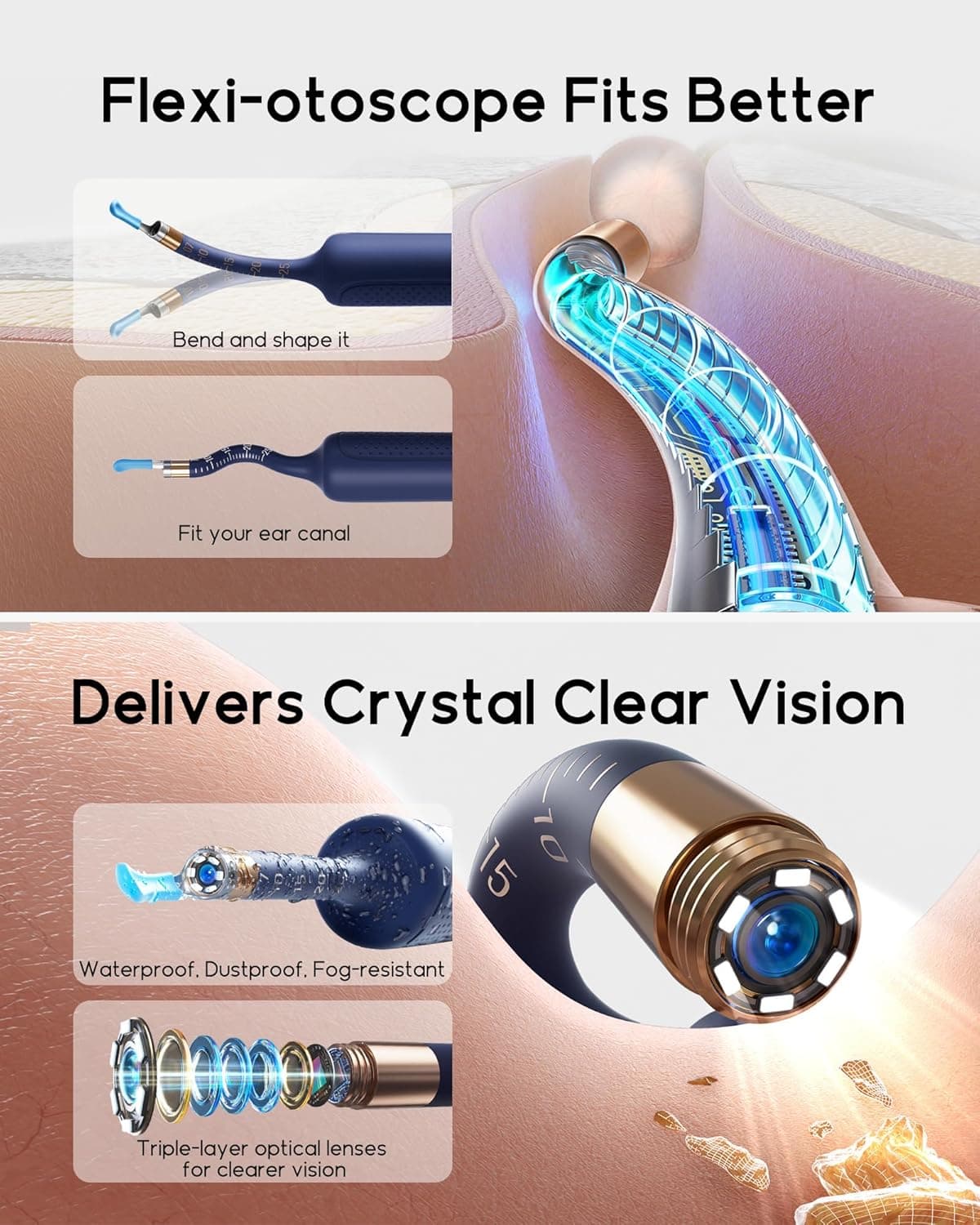 گوش پاک کن هوشمند شیائومی مدل Bebird Earsight Plus — تصویر ۴