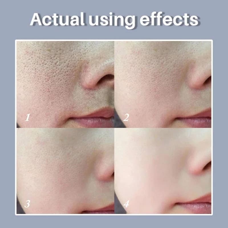 سرم کوچک کننده منافذ لانبنا 15ml — تصویر ۳