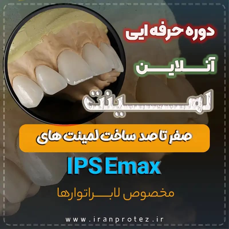 دوره تخصصی و آنلاین لمینت Emax | آموزش طراحی و ساخت لبخند زیبا