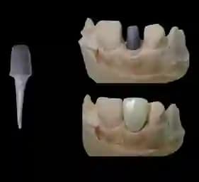 دوره آنلاین پست و کور – مینی دوره — تصویر ۴