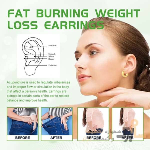 گوشواره کاهش اشتها وزن مدل Fat Burning ایلهو EELHOE — تصویر ۳