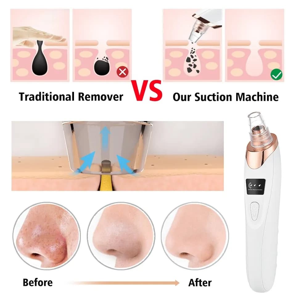 میکرودرم پاک سازی و مراقبت از پوست — تصویر ۶