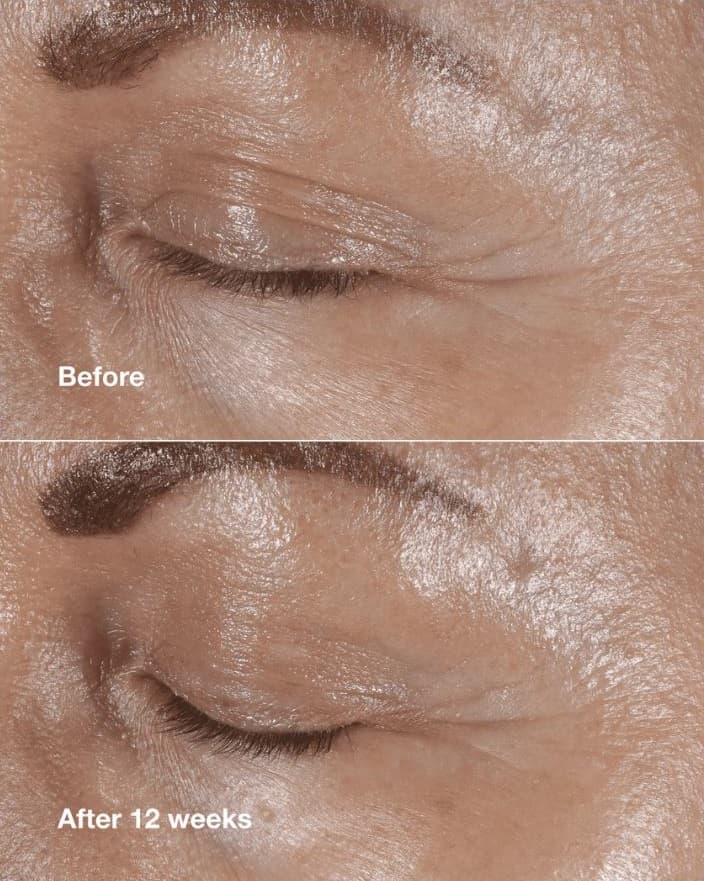 کرم دور چشم Clinique Smart Clinical Repair Wrinkle Correcting Eye Cream حجم 15 میل — تصویر ۲