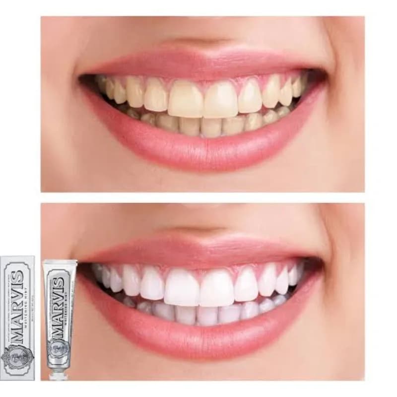 خمیر دندان سفید کننده مارویس مدل Whitening Mint حجم 85 میلی لیتر — تصویر ۵
