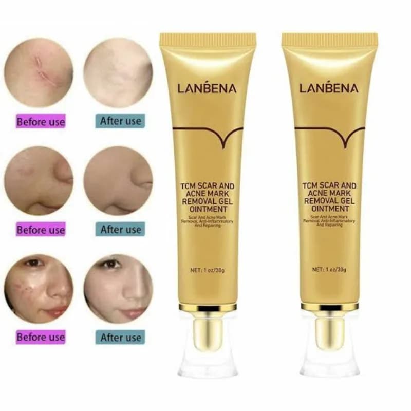 ژل ترمیم کننده جای جوش و زخم لانبنا Lanbena مدل TCM حجم 30 گرم — تصویر ۳