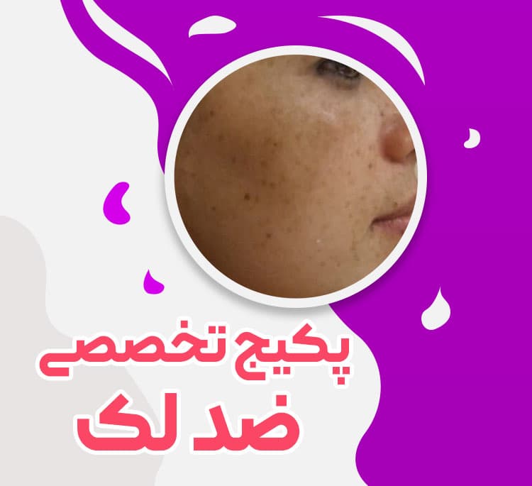 پک تخصصی ضد لک
