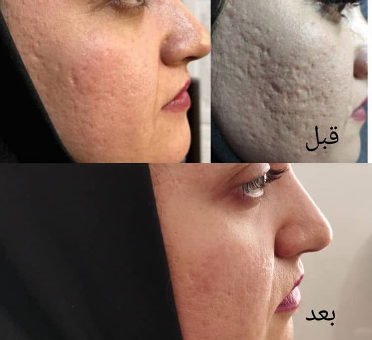 پك تخصصي منافذ باز صورت لاکچری کوین — تصویر ۲