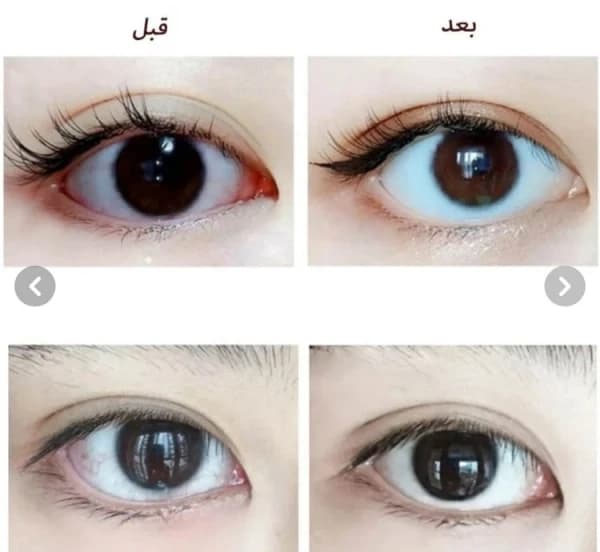 اسپری و بخور چشم نانو مدل CY-102 — تصویر ۴