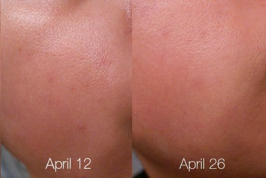 تونر سالیسیلیک اسید پائولاز چویس Paulas Choice BHA Liquid Exfoliant – حجم 30 میل — تصویر ۴