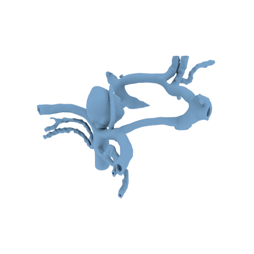 آنوریسم حلقه ویلیس (circle of willis aneurysm) — تصویر ۲