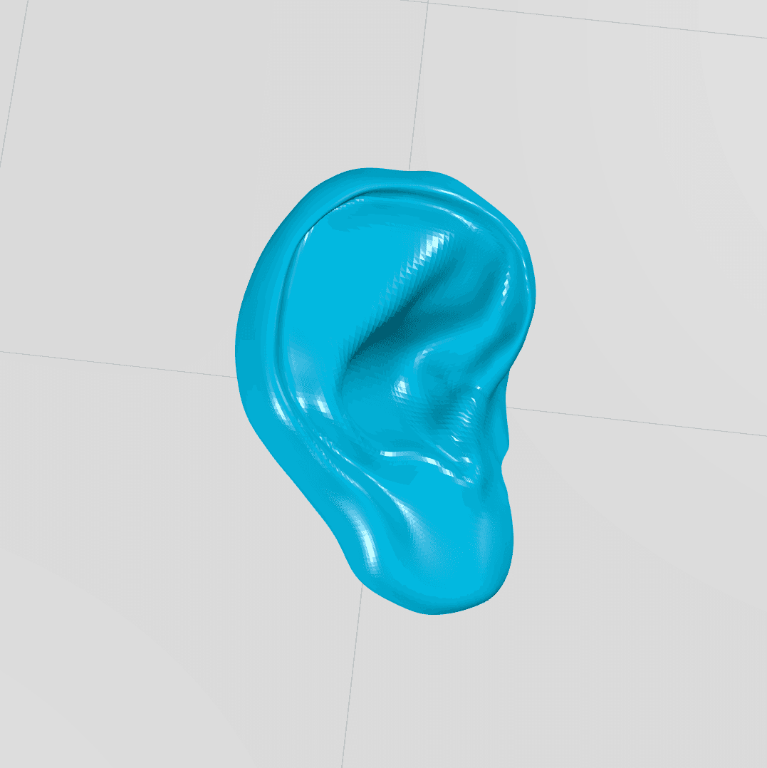 مولاژ گوش خارجی(external ear)