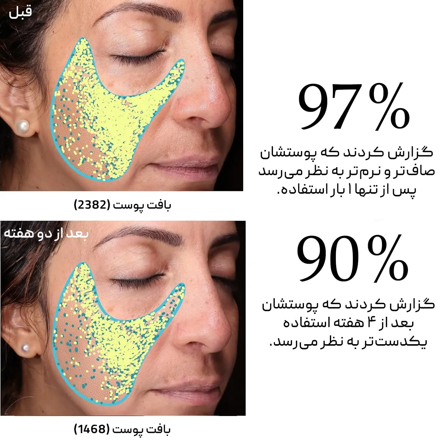 اسکراب لایه بردار صورت دکتر برنت Dr.Brandt — تصویر ۲
