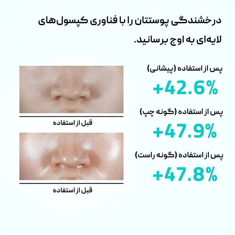 اسپری میست آبرسان هیالورونیک کپسولی آنوا Anua — تصویر ۳