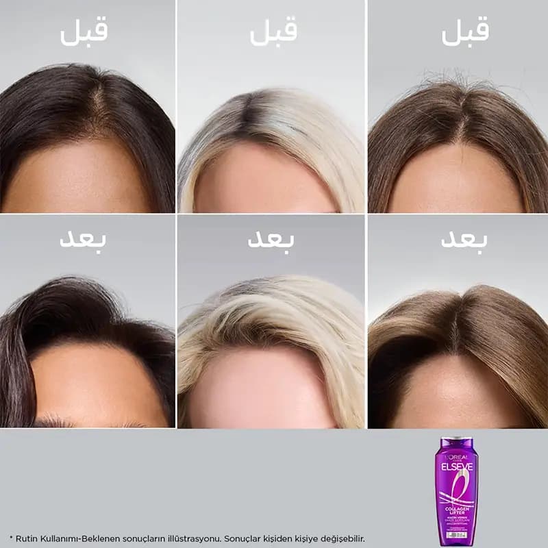 شامپو لیفتر السیو لوریل Loreal Elseve — تصویر ۳