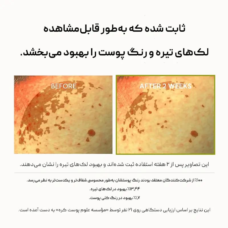 بوستر شات ویتامین سی آرنسیا Arencia Vitamin C — تصویر ۴